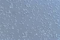Oursin - Spermatozoïdes vivants x100